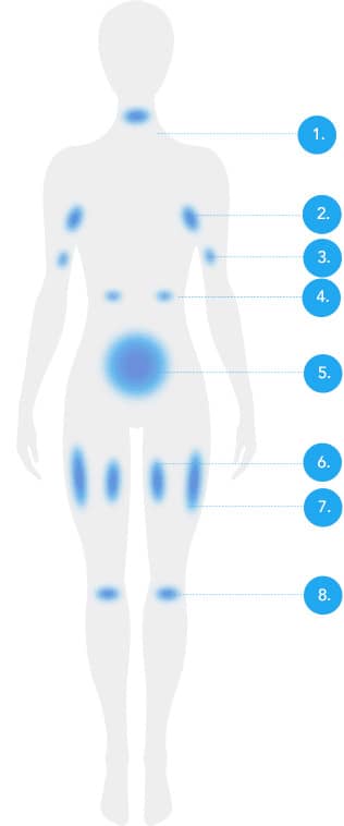 CoolSculpting fat freezing Amsterdam - front body diagram with numbered treatable fat areas Front body diagram with numbered treatable fat areas for CoolSculpting fat freezing in Amsterdam